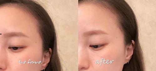 眼霜吃瓜,揭秘眼部保养的甜蜜诱惑  第2张